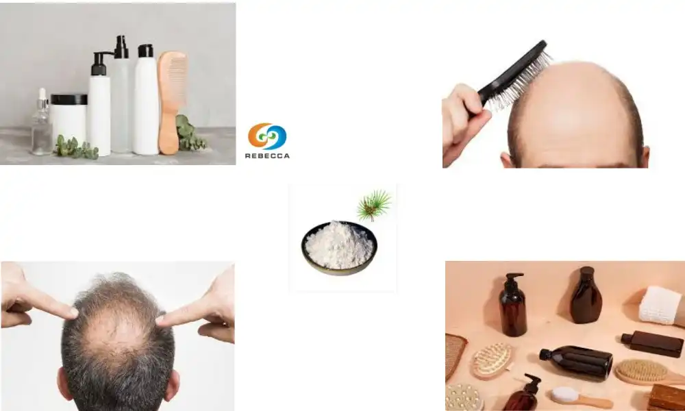 Can saw palmetto stop hair loss?